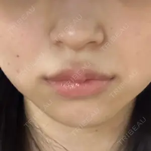 TCB東京中央美容外科 TCB東京中央美容外科 渋谷東口院口コミ