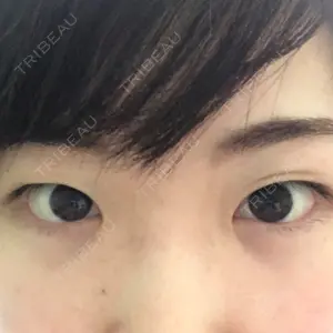 口コミ
