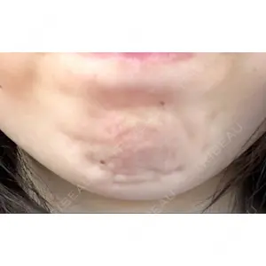 フィラークリニック フィラークリニック 町田院口コミ