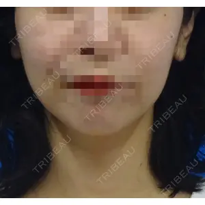 TCB東京中央美容外科 TCB東京中央美容外科 新横浜院口コミ