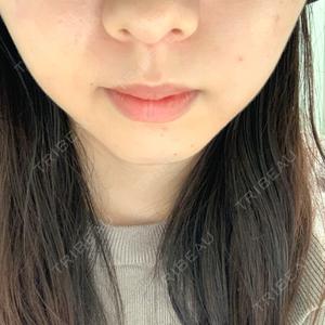 TCB東京中央美容外科 TCB東京中央美容外科 町田院口コミ
