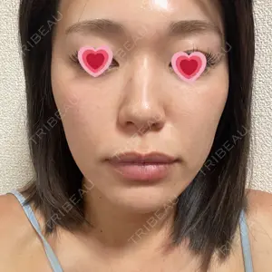 口コミ
