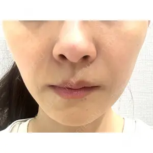 湘南美容クリニック 湘南美容クリニック 静岡院口コミ