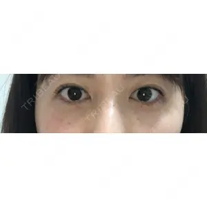 口コミ