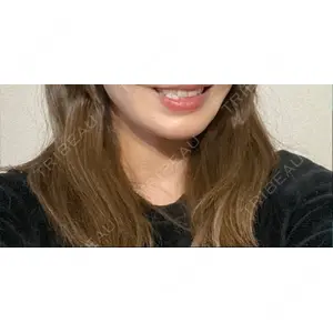 U DENTAL OFFICE 恵比寿口コミ
