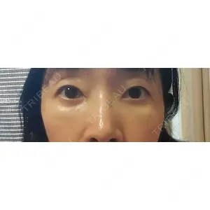 TCB東京中央美容外科 TCB東京中央美容外科 倉敷院口コミ