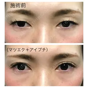 中央クリニック 大阪梅田中央クリニック美容外科口コミ