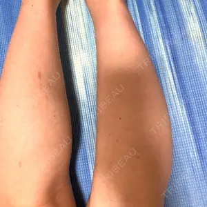 DMTC美容皮膚科 DMTC美容皮膚科 渋谷院口コミ