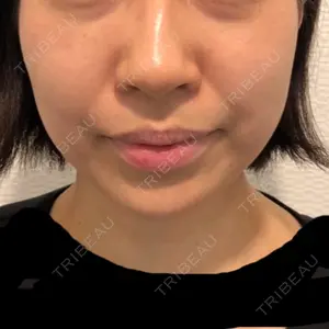 A CLINIC（エークリニック） A CLINIC（エークリニック） 横浜院口コミ