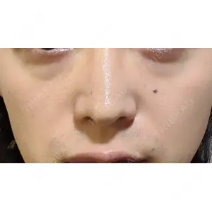 プラストクリニック口コミ