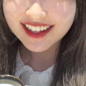 あいちビューティークリニック あいちビューティークリニック栄本院口コミ