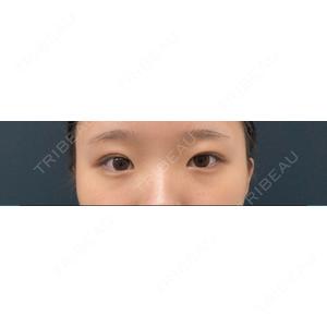 湘南美容クリニック 湘南美容クリニック 京都院口コミ