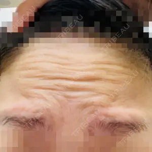 TCB東京中央美容外科 TCB東京中央美容外科 新宿東口院口コミ