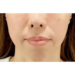 X CLINIC X CLINIC 恵比寿院口コミ