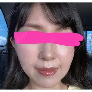 プラチナクリニック口コミ