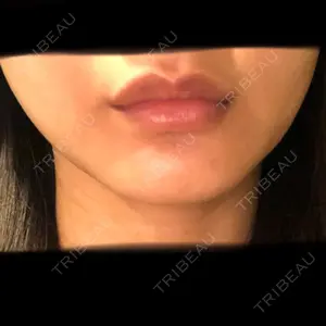 湘南美容クリニック 湘南美容クリニック 新宿南口院口コミ