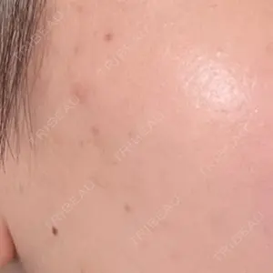 まゆりなclinic 名古屋栄口コミ