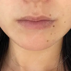 DMTC CLINIC DMTC CLINIC 日本橋院口コミ