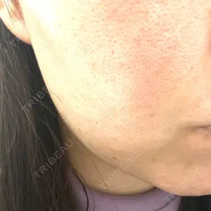 Re:anne clinic 銀座 【リアンクリニック銀座】口コミ
