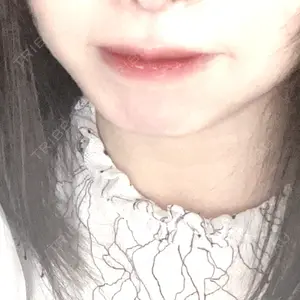 フィラークリニック フィラークリニック 名古屋栄院口コミ