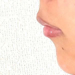 ルラ美容クリニック ルラ美容クリニック 高田馬場院口コミ