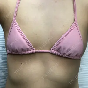 TCB東京中央美容外科 TCB東京中央美容外科 中野院口コミ