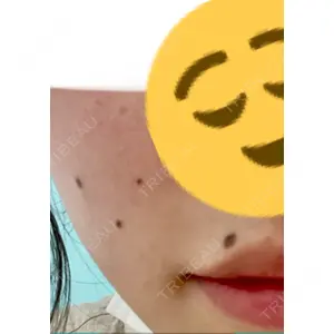 口コミ