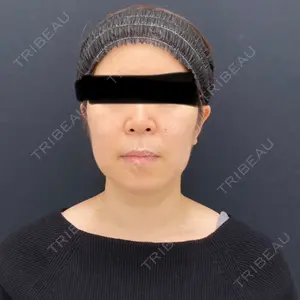 湘南美容クリニック 湘南美容クリニック 秋葉原院口コミ