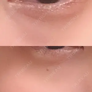 東京イセアクリニック口コミ