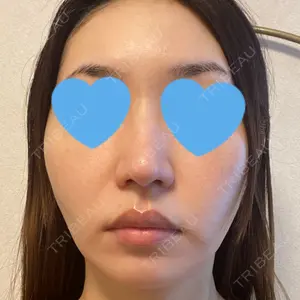 口コミ