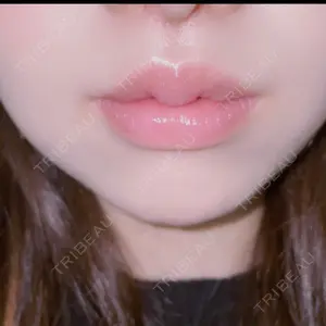 フィラークリニック フィラークリニック 町田院口コミ