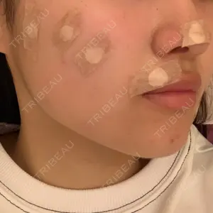 ニューセンス皮膚科クリニック口コミ