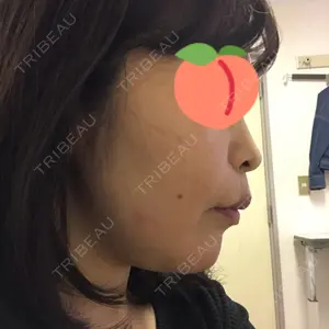 口コミ