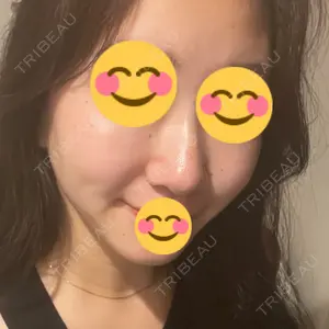 BIANCA CLINIC BIANCA銀座口コミ