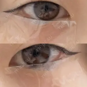AI Beauty Clinic （エーアイ美容クリニック）口コミ