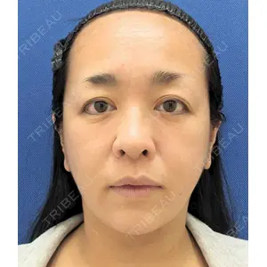 湘南美容クリニック 湘南美容クリニック 表参道院口コミ