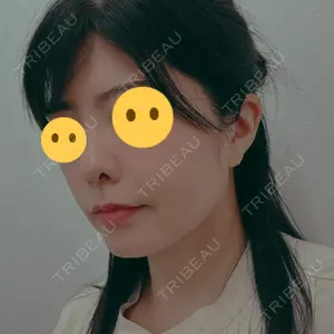 TCB東京中央美容外科 TCB東京中央美容外科 柏院口コミ