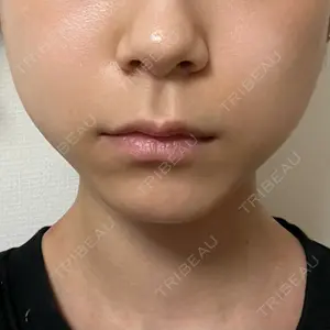 TCB東京中央美容外科 TCB東京中央美容外科 渋谷東口院口コミ
