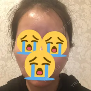 RG整形外科（旧リオン整形外科）口コミ