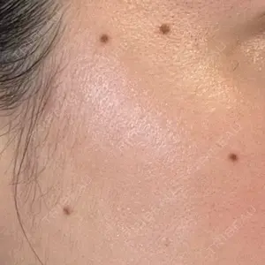 Jスキンクリニック 【J-SKIN clinic】口コミ