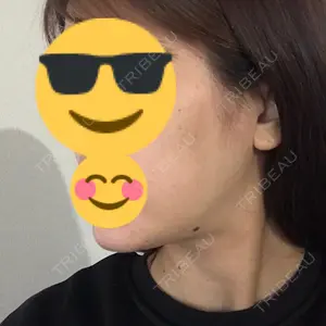 口コミ