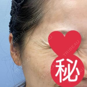 湘南美容クリニック 湘南美容クリニック 大阪梅田本院口コミ