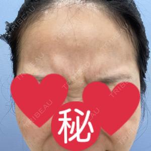 湘南美容クリニック 湘南美容クリニック 大阪梅田本院口コミ