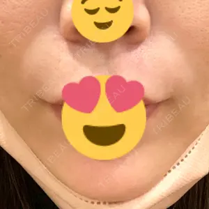 口コミ