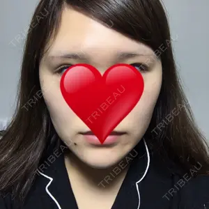 RG整形外科（旧リオン整形外科）口コミ