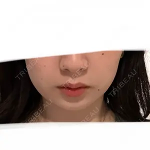 TCB東京中央美容外科 TCB東京中央美容外科 渋谷東口院口コミ