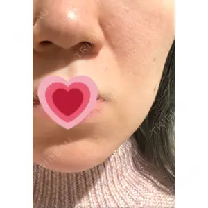 口コミ
