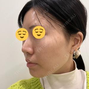 湘南美容クリニック 湘南美容クリニック 静岡院口コミ