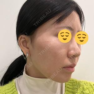 湘南美容クリニック 湘南美容クリニック 静岡院口コミ
