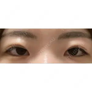 BLINC CLINIC （ブリンク クリニック）口コミ
